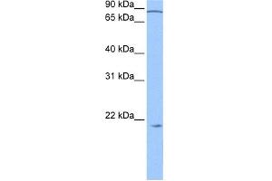 WB Suggested Anti-ARPC3 Antibody Titration: 0.