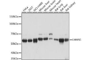 Western blot analysis of extracts of various cell lines, using LM Rabbit mAb (ABIN7268205) at 1:1000 dilution. (LMAN1 抗体)