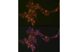 Immunofluorescence analysis of NIH-3T3 cells using ACADM Rabbit mAb (ABIN1678538, ABIN3019056, ABIN3019057 and ABIN7101707) at dilution of 1:100 (40x lens). (Medium-Chain Specific Acyl-CoA Dehydrogenase, Mitochondrial 抗体)