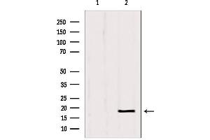 Western blot analysis of extracts from Hela, using SRP14 antibody. (SRP14 抗体  (Internal Region))