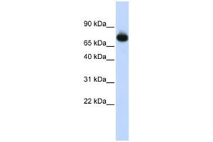 WB Suggested Anti-PATZ1 Antibody Titration:  0. (PATZ1 抗体  (Middle Region))