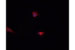 ABIN6269006 staining A-431 cells by IF/ICC. (Metabotropic Glutamate Receptor 6 抗体  (C-Term))