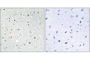 Immunohistochemistry analysis of paraffin-embedded human brain tissue, using SSBP2 Antibody. (SSBP2 抗体  (AA 10-59))