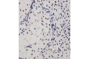 (ABIN6244107 and ABIN6577237) staining SUFU in mouse embryo tissue sections by Immunohistochemistry (IHC-P - paraformaldehyde-fixed, paraffin-embedded sections). (SUFUH 抗体)