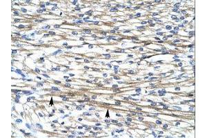 Image no. 1 for anti-Four and A Half LIM Domains 2 (FHL2) (AA 199-248) antibody (ABIN202003) (FHL2 抗体  (AA 199-248))