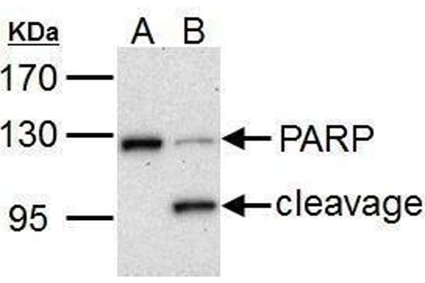 PARP1 抗体