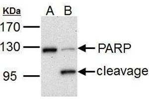 PARP1 抗体