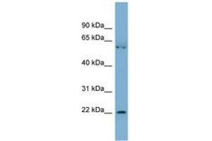 Image no. 1 for anti-Slowmo Homolog 2 (SLMO2) (AA 35-84) antibody (ABIN6742141) (SLMO2 抗体  (AA 35-84))