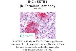 Image no. 1 for anti-Somatostatin Receptor 1 (SSTR1) (Extracellular Domain), (N-Term) antibody (ABIN1739669) (SSTR1 抗体  (Extracellular Domain, N-Term))