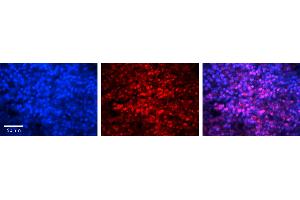 Rabbit Anti-MAX Antibody   Formalin Fixed Paraffin Embedded Tissue: Human Lymph Node Tissue Observed Staining: Nucleus Primary Antibody Concentration: 1:100 Other Working Concentrations: N/A Secondary Antibody: Donkey anti-Rabbit-Cy3 Secondary Antibody Concentration: 1:200 Magnification: 20X Exposure Time: 0. (MAX 抗体  (Middle Region))