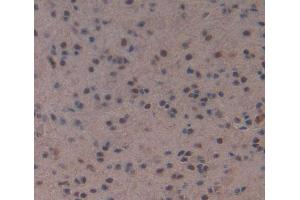 Used in DAB staining on fromalin fixed paraffin- embedded Kidney tissue (MEF2A 抗体  (AA 1-160))
