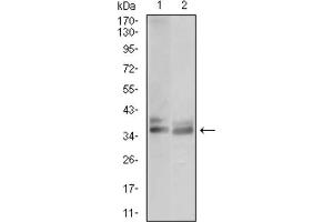 Western Blotting (WB) image for anti-Acid Phosphatase 5, Tartrate Resistant (ACP5) (AA 221-325) antibody (ABIN1846241) (ACP5 抗体  (AA 221-325))