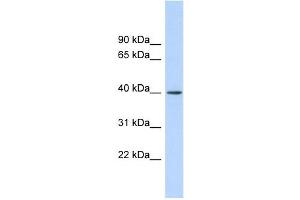 RAD51AP1 antibody used at 1 ug/ml to detect target protein. (RAD51AP1 抗体  (Middle Region))