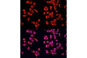 Immunofluorescence (IF) image for anti-Y Box Binding Protein 1 (YBX1) (AA 100-200) antibody (ABIN7271411)