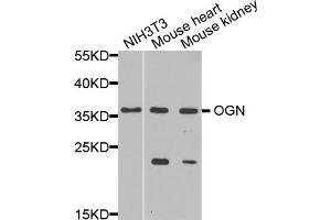 Western blot analysis of extracts of various cell lines, using OGN antibody. (OGN 抗体)