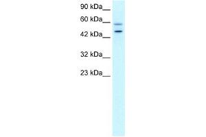 Human HepG2; WB Suggested Anti-DKFZP761C169 Antibody Titration: 0.