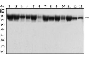 Western Blotting (WB) image for anti-Catenin (Cadherin-Associated Protein), beta 1, 88kDa (CTNNB1) (AA 632-781) antibody (ABIN7193682)