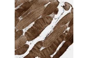 Immunohistochemical staining of human skeletal muscle with MB21D1 polyclonal antibody  shows strong cytoplasmic positivity in myocytes. (C6orf150 抗体)