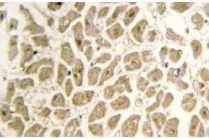 Immunohistochemistry (IHC) analyzes of Siah-2 antibody in paraffin-embedded human heart tissue. (SIAH2 抗体)