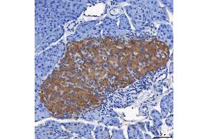 IHC analysis of SEL1L using anti-SEL1L antibody (ABIN7599665).