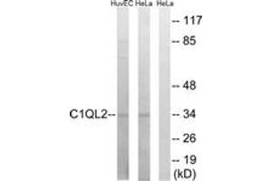 Western blot analysis of extracts from HeLa/HuvEc cells, using C1QL2 Antibody. (C1QL2 抗体  (AA 231-280))