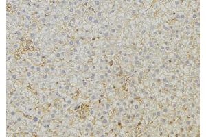 ABIN6279555 at 1/100 staining Mouse liver tissue by IHC-P. (ABCC6 抗体  (Internal Region))