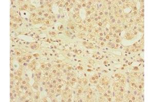 Immunohistochemistry of paraffin-embedded human adrenal gland tissue using ABIN7158982 at dilution of 1:100 (MPI 抗体  (AA 1-423))