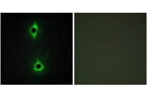 Immunofluorescence (IF) image for anti-phosphoinositide Kinase, FYVE Finger Containing (PIKFYVE) (AA 71-120) antibody (ABIN2889821) (PIKFYVE 抗体  (AA 71-120))