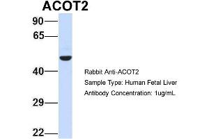 Host: Rabbit Target Name: ACOT2 Sample Type: Human Fetal Liver Antibody Dilution: 1. (ACOT2 抗体  (Middle Region))