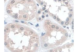Immunohistochemistry (IHC) image for anti-Barrier To Autointegration Factor 1 (BANF1) (AA 2-89) antibody (ABIN7444295)