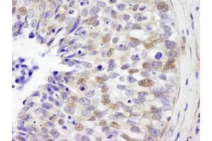 Immunohistochemistry (IHC) image for anti-Interferon Regulatory Factor 3 (IRF3) (AA 100-150) antibody (ABIN7448610)