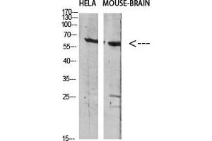 Western Blotting (WB) image for anti-GABA Transporter 1 (GAT1) antibody (ABIN5956621) (SLC6A1 抗体)