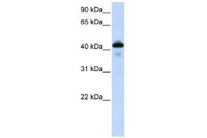 SFTPB antibody used at 1 ug/ml to detect target protein. (SFTPB 抗体  (Middle Region))