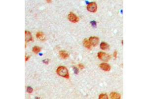 Immunohistochemistry (IHC) image for anti-Cytochrome P450, Family 2, Subfamily C, Polypeptide 19 (CYP2C19) (Center) antibody (ABIN7301582)