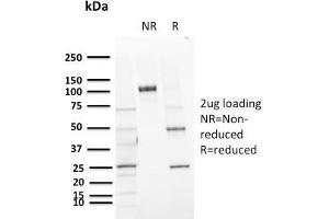 SDS-PAGE Analysis Purified CD72 Mouse Monoclonal Antibody (BU40). (CD72 抗体)