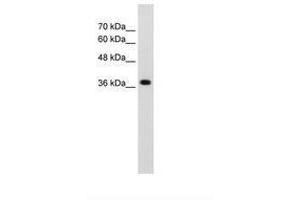 Image no. 2 for anti-LON Peptidase N-terminal Domain and Ring Finger 1 (LONRF1) (N-Term) antibody (ABIN203536) (LONRF1 抗体  (N-Term))