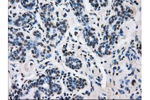 Immunohistochemical staining of paraffin-embedded breast tissue using anti-L1CAM mouse monoclonal antibody. (L1CAM 抗体)