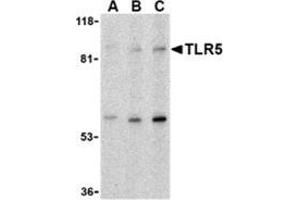 Western blot analysis of TLR5 in THP-1 cell lysate with this product at (A) 0. (TLR5 抗体  (C-Term))