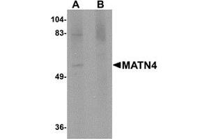 Western Blotting (WB) image for anti-Matrilin 4 (MATN4) (N-Term) antibody (ABIN1031453) (MATN4 抗体  (N-Term))