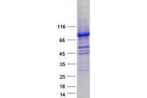 Western Blotting (WB) image for Diacylglycerol Kinase, alpha 80kDa (DGKA) (Transcript Variant 3) protein (Myc-DYKDDDDK Tag) (ABIN2715547)