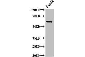 Western Blot Positive WB detected in: HepG2 whole cell lysate All lanes: ST6GALNAC1 antibody at 2. (ST6GALNAC1 抗体  (AA 36-249))