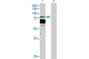 Western Blot analysis of PRKCB expression in transfected 293T cell line by PRKCB MaxPab polyclonal antibody. (PKC beta 抗体  (AA 1-671))