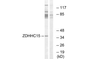 Western blot analysis of extracts from Jurkat cells, using ZDHHC15 antibody. (ZDHHC15 抗体  (C-Term))