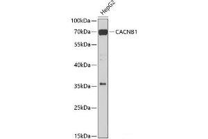 Western blot analysis of extracts of HepG2 cells using CACNB1 Polyclonal Antibody at dilution of 1:1000. (CACNB1 抗体)