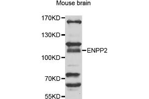 Western blot analysis of extracts of mouse brain, using ENPP2 antibody (ABIN5975354) at 1/1000 dilution. (ENPP2 抗体)