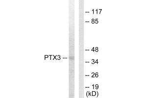 Western Blotting (WB) image for anti-Pentraxin 3 (PTX3) (N-Term) antibody (ABIN1849270) (PTX3 抗体  (N-Term))