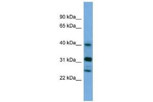 PPHLN1 antibody used at 0. (PPHLN1 抗体  (N-Term))