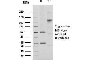 SDS-PAGE (SDS) image for anti-HLA-DR-gamma (CD74) antibody (ABIN6941259)