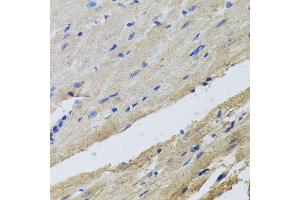 Immunohistochemistry of paraffin-embedded rat heart using FECH antibody at dilution of 1:100 (x40 lens). (FECH 抗体)