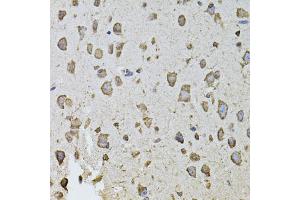 Immunohistochemistry of paraffin-embedded mouse brain using FGF2 antibody (ABIN5970065) at dilution of 1/100 (40x lens). (FGF2 抗体  (N-Term))